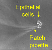 Patching of pancreatic duct epithelial cells